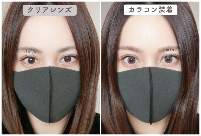 ロールモデルレポ装着画像引きで裸眼比較