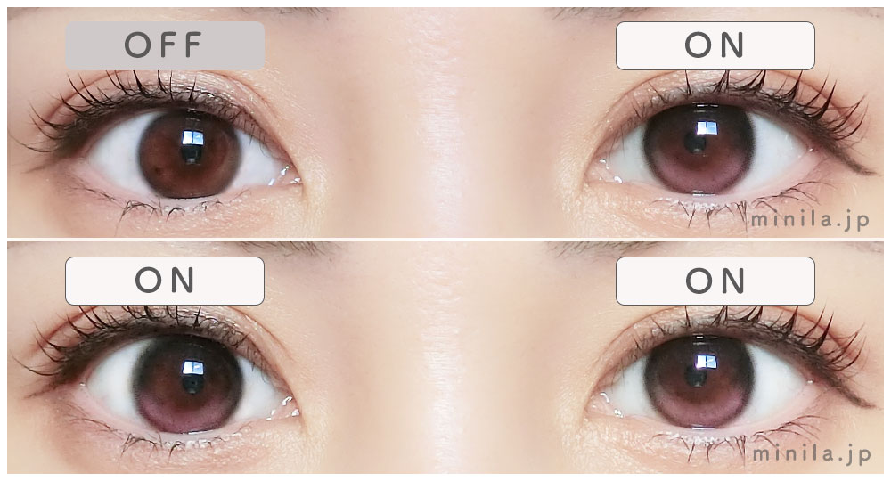 ピンクデューレポ装着画像両目