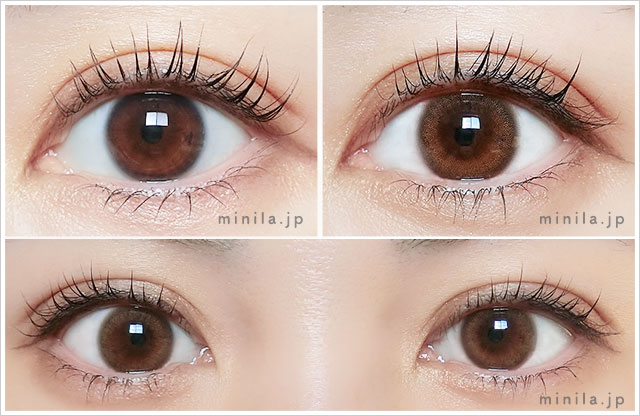 ポラリス装着画像正面