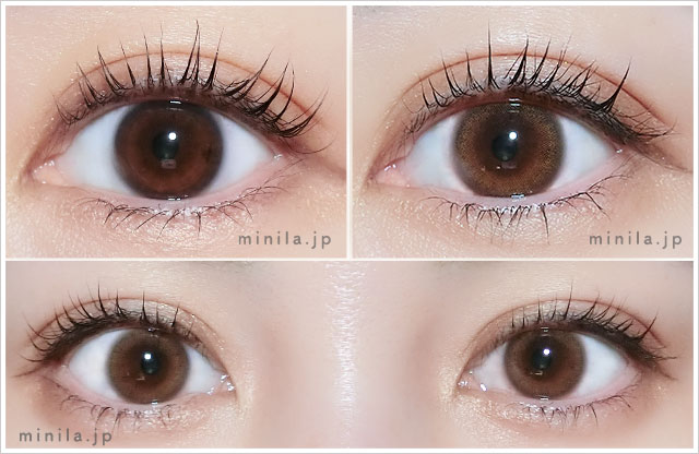 ポラリスレポ装着画像正面