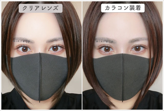 ポラリスレポ装着画像引きで裸眼比較