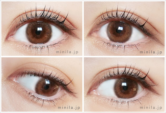 ポラリスレポ装着画像色んな角度から