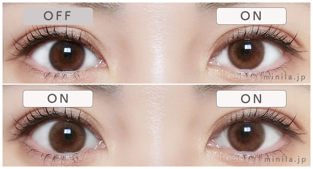 ポラリスレポ装着画像両目