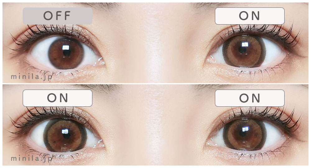 メルプリンレポ装着画像両目