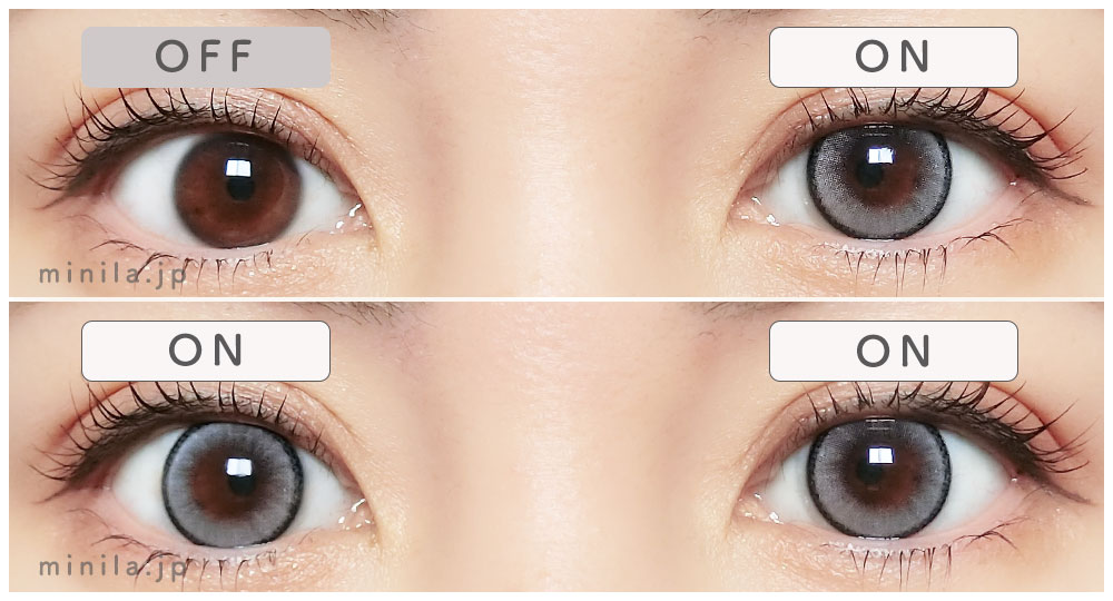 ドリップアウトレポ装着画像両目