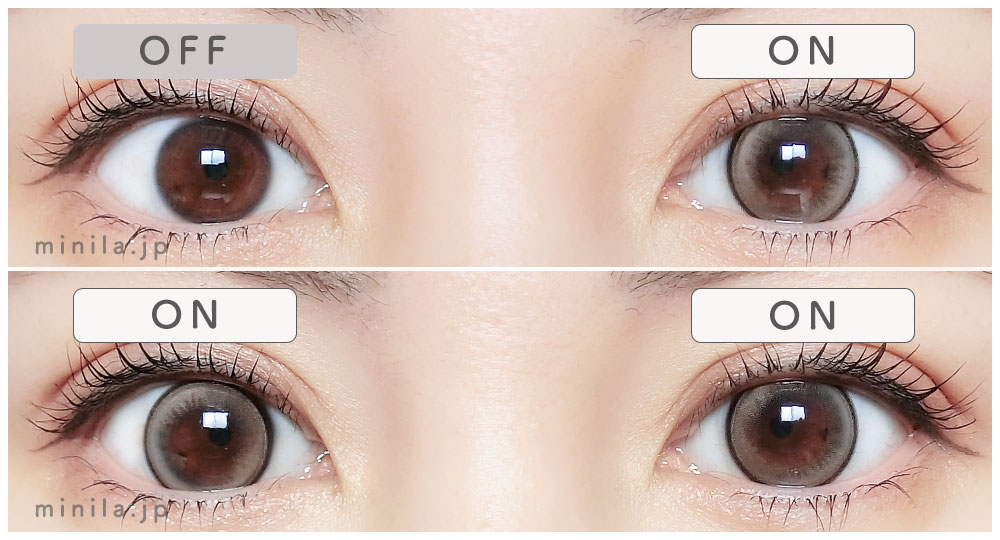 フェードラインレポ装着画像両目