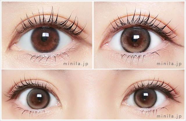 ロレ装着画像正面