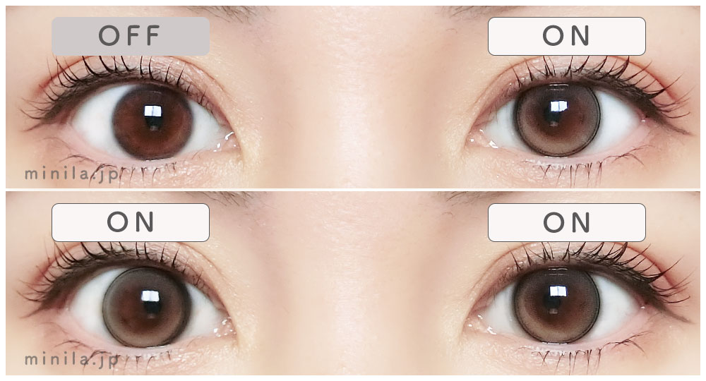 ロレレポ装着画像両目