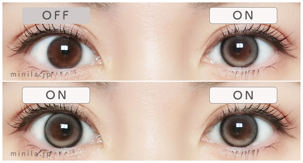 ニルレポ装着画像両目