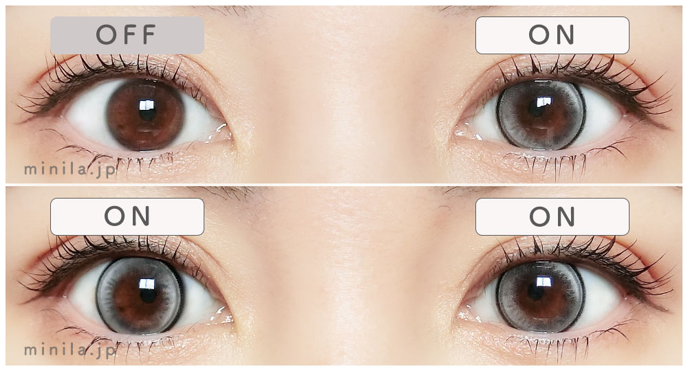 ノーンレポ装着画像両目